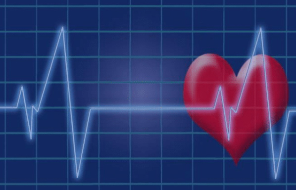 ECG of a heart